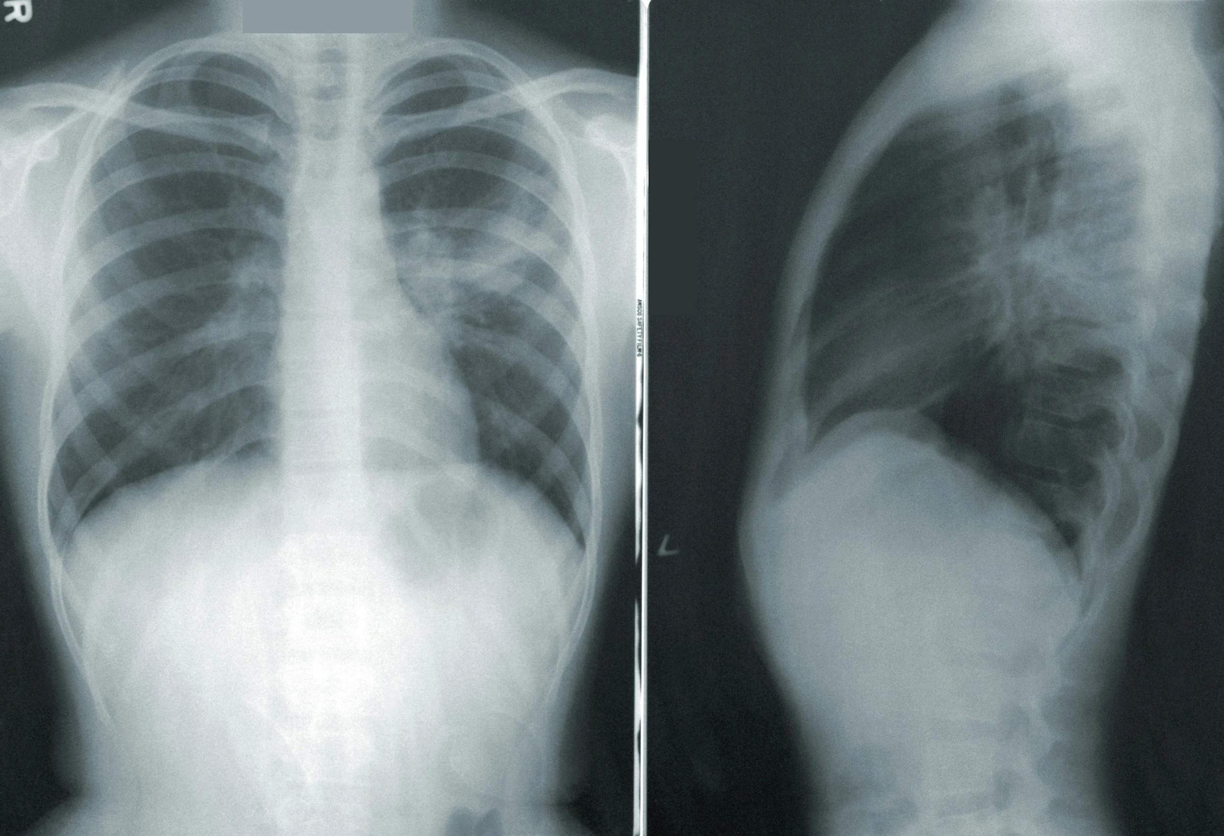 7 Industries that Put Employees at Risk for Lung Damage