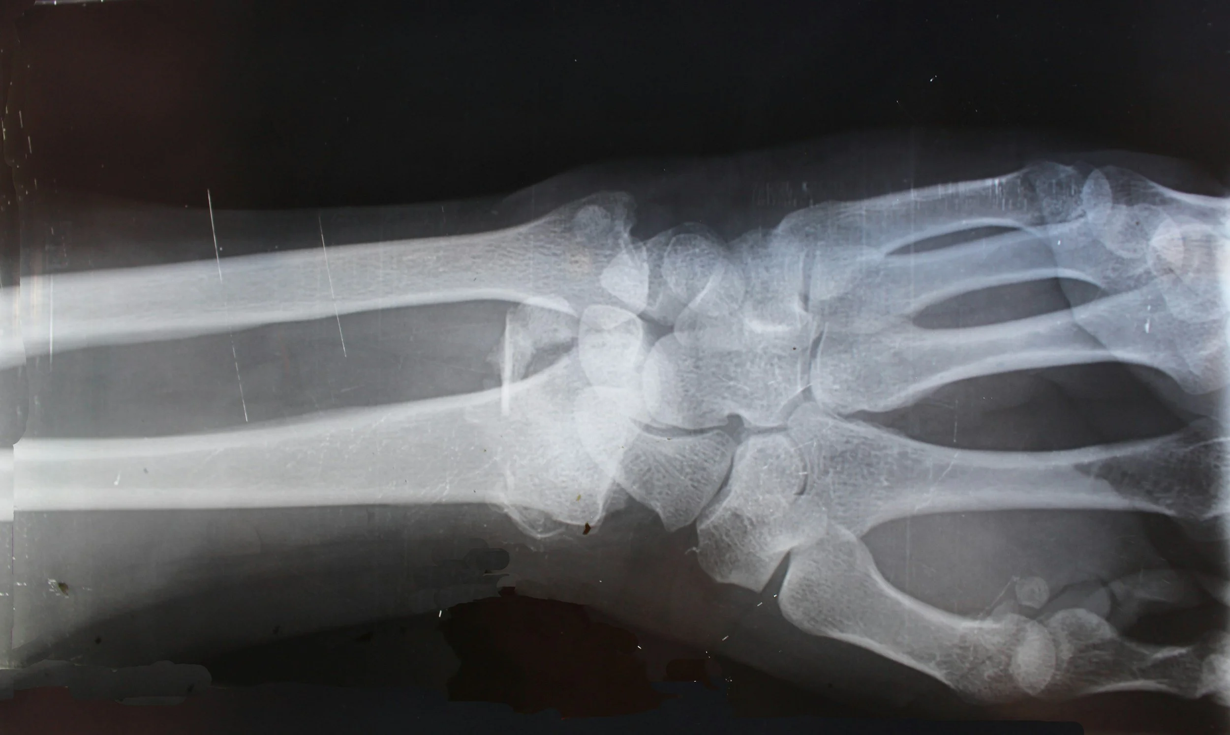How to Communicate with Your Employer After a Work-Related Injury