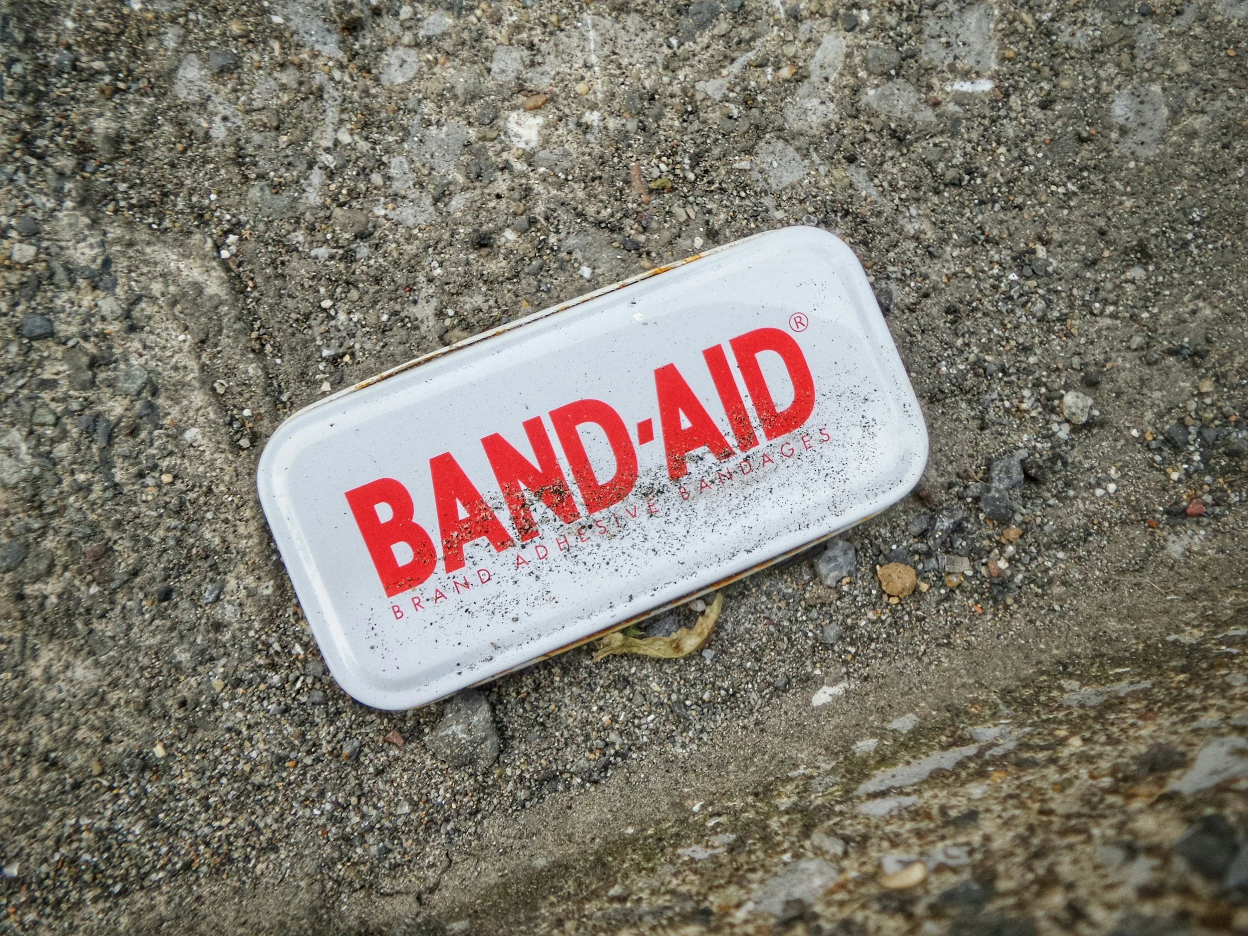 Should I Report Minor Work Injuries?