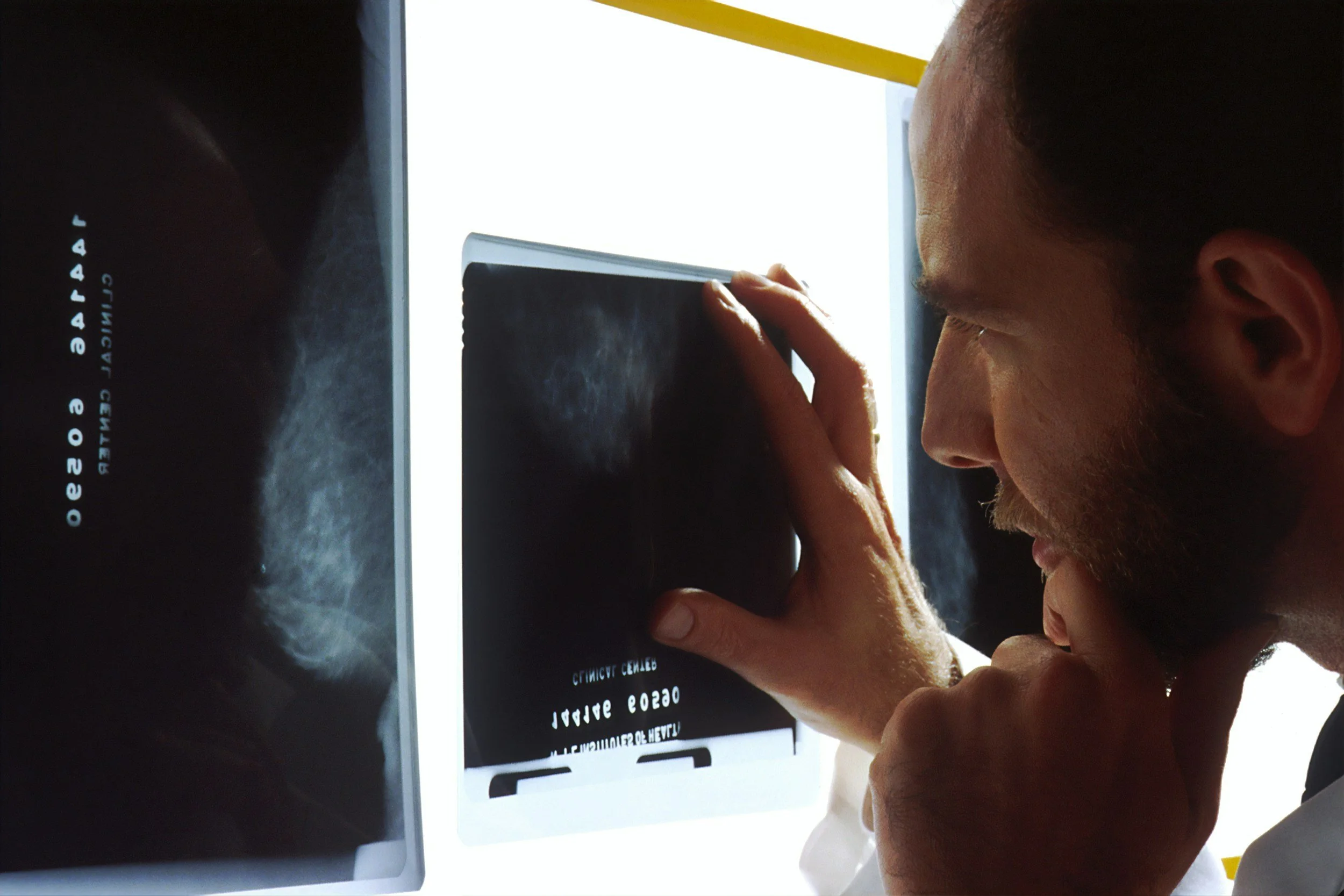 someone examining an x-ray