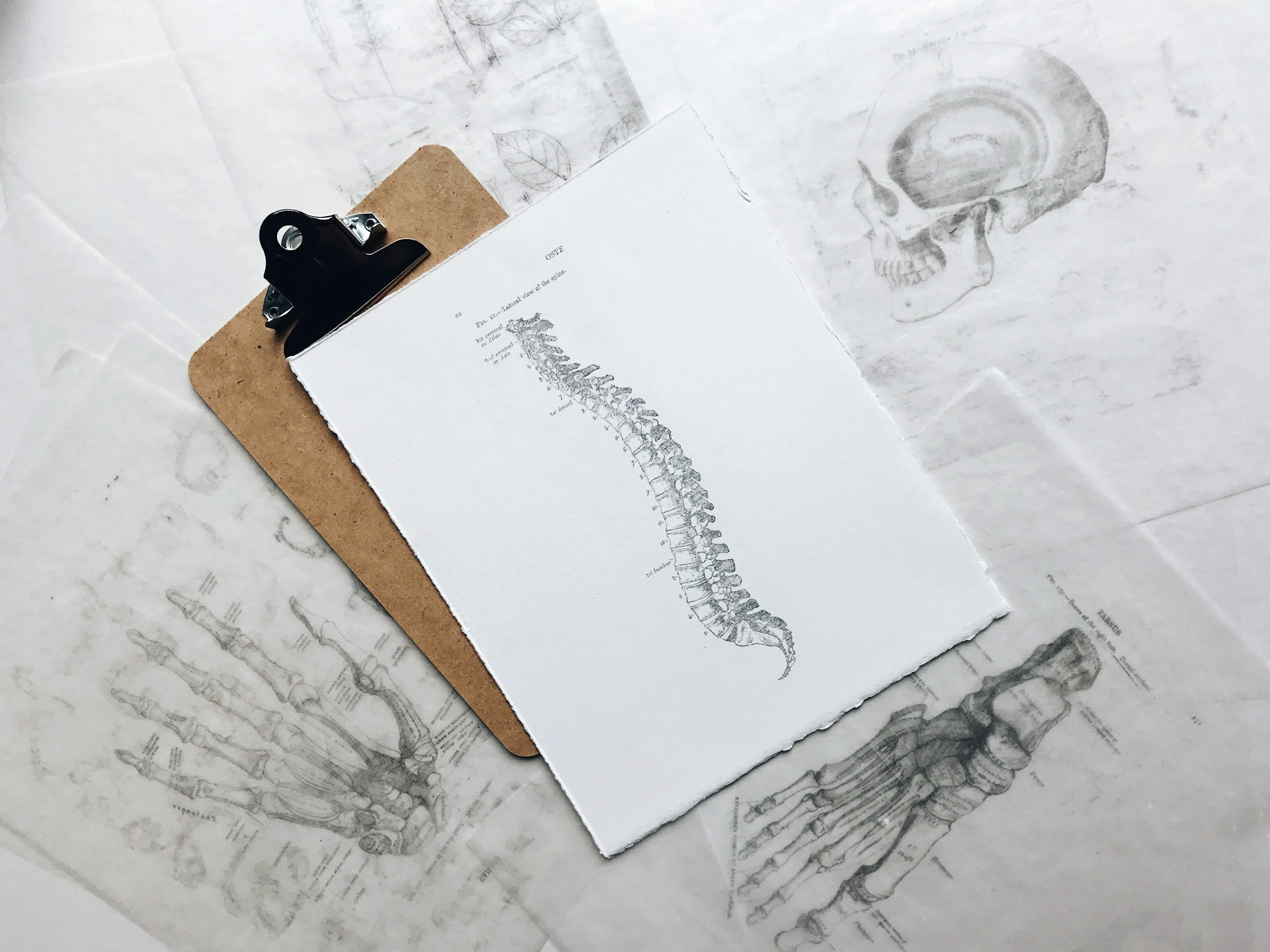 The Impact of Pre-Existing Conditions on Workers' Compensation Claims